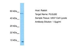 PLGLB2 Rabbit anti-Human, Polyclonal, Novus Biologicals 0.1 mL | Buy Online | Novus Biologicals | Fisher Scientific